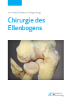 Marcus Christian Müller, Oliver Weber, Christof Burger - Chirurgie des Ellenbogens